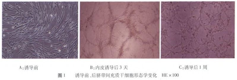 体检中最易被忽视的第五“高”，竟是动脉硬化的元凶？(图12)